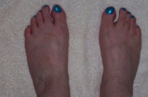 my ugly feet modelling the turquoise nail varnish